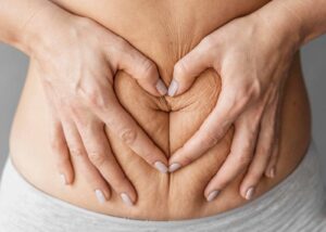 Tummy-tuck at Beautyland Plastic Surgery