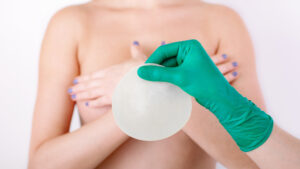 Implant Removal in Miami