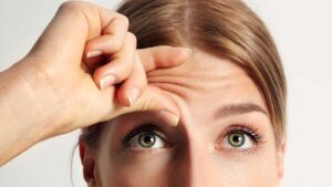 Forehead Lift in Miami- Refresh Your Look with Subtle Precision